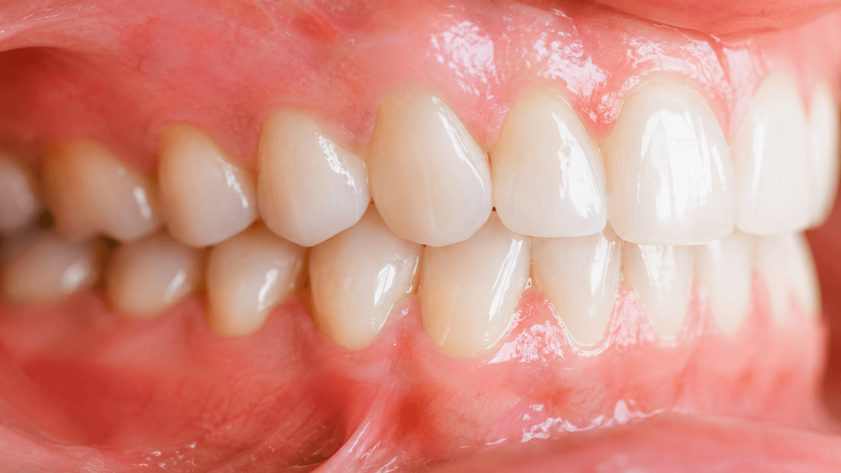 Periodoncia